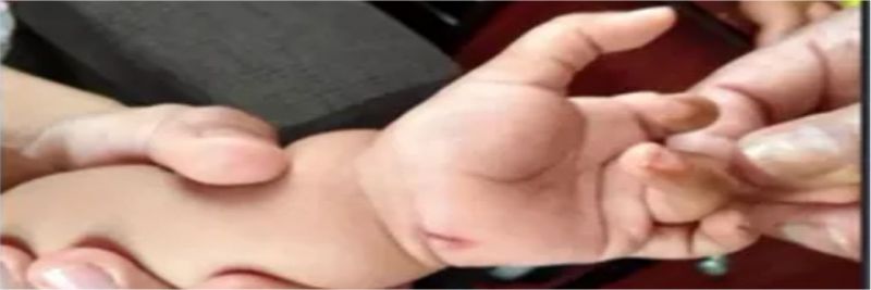 Bebê de um ano e dois meses foi atingida por três golpes de faca pelo próprio pai, em Rolândia