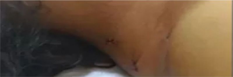 Mulher foi atingida por facadas no pescoço, nos braços, pernas e tórax, em Rolândia