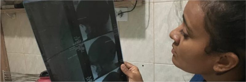 Leiliane Rafael olha um dos exames que fez para descobrir que tem doença rara